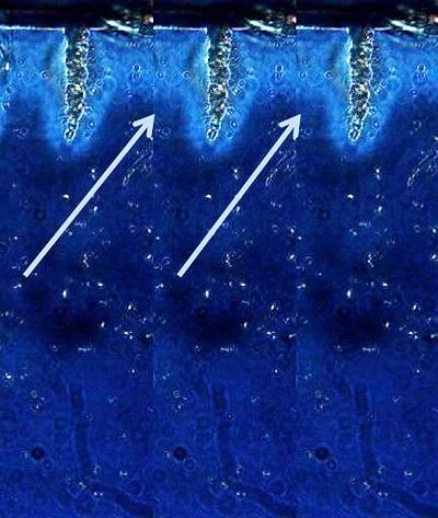 Fraksiyonle-CO2-lazer-pulse-sresi-2.jpg