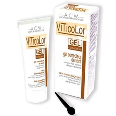 Vitiligo-Ala-Hastal17.jpg