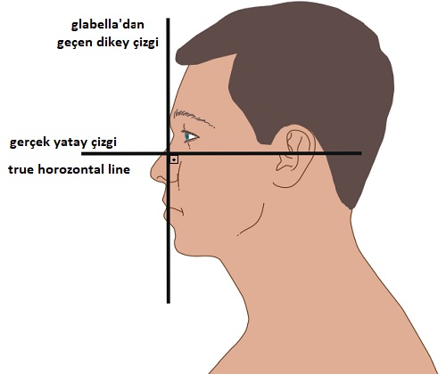 Çenenin Estetik Analizi