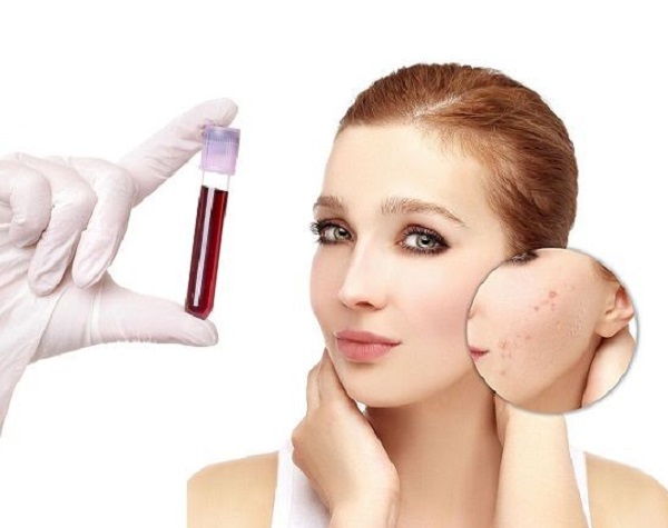 Aknede İstenecek Testler