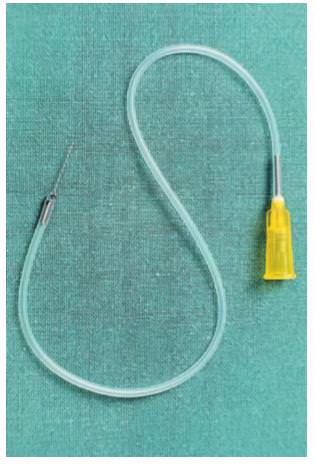 Skleroterapide İğne ve Enjektörler Skleroterapide İğne ve Enjektörler