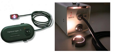 Transilluminasyon Transilluminasyon