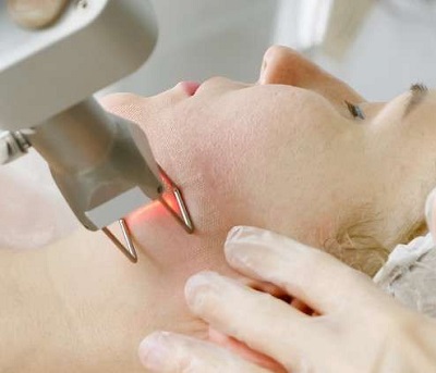 Atrofik Akne İzlerinde Fraksiyonel CO2 Lazer ve Topikal İnsülin ve PRP Birlikteliği