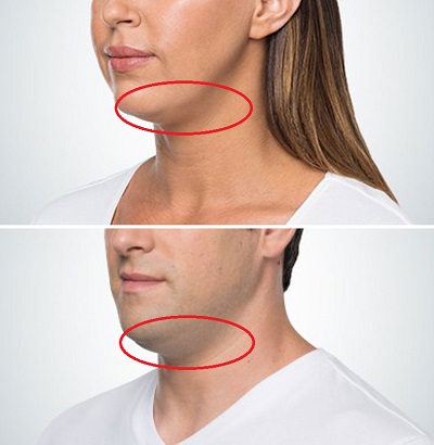 iplik-boyun-germe-asma.jpg