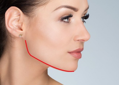 Çene ve Çene Hattı(Jawline) Dolgu Uygulamaları