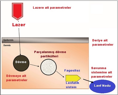 Lazer Dövme Silme Sonuçlarını Etkileyen Faktörler