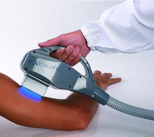 Psoriasis Sedef Hastalığı Tedavisi 308 ve 311 nm Mikro Fototerapi