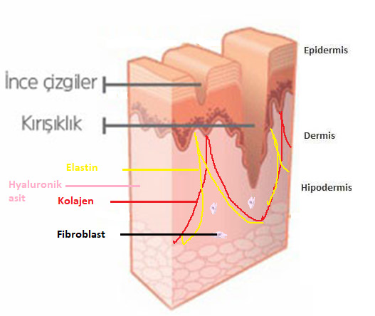Otolog Fibroblast Hücre Tedavisi (Fibrocell)