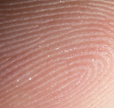 Metallerin Vücuttan Atılım Organı Olarak Deri