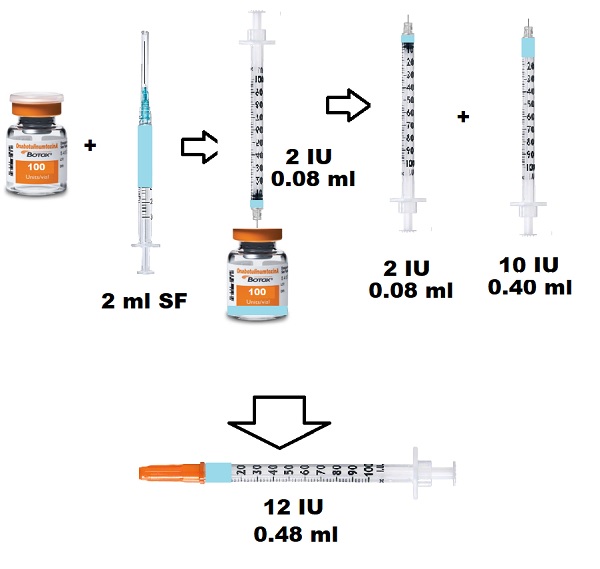 mikro_botox_hazirlanmasi.jpg