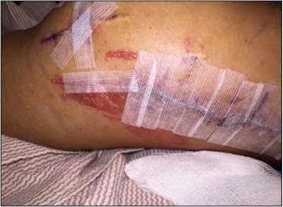 nikel-ve-ortopedik-dermatitis.jpg