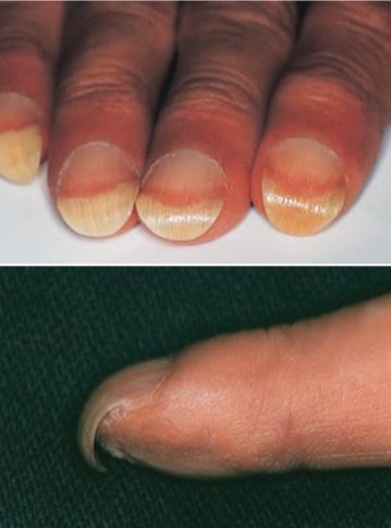 papagan-gagasi-tirnak-parrot-beak-nails.jpg