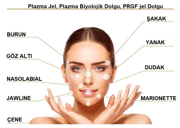 Plazma Jel, Plazma Biyolojik Dolgu, PRGF jel Dolgu