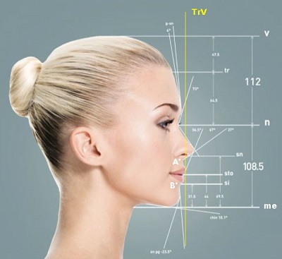 Yüz Esteteik Analizi, Yüz Profil Estetiği, Yüzün Profilden Estetik Degerlendirmesi 