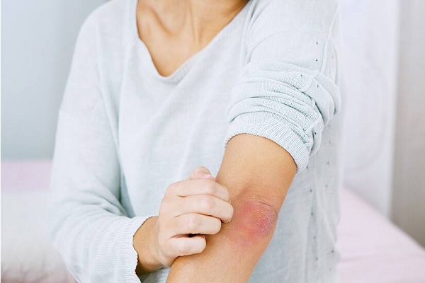Psikolojik-Dermatolojik Cilt Hastalıkları, Psikodermatozlar 