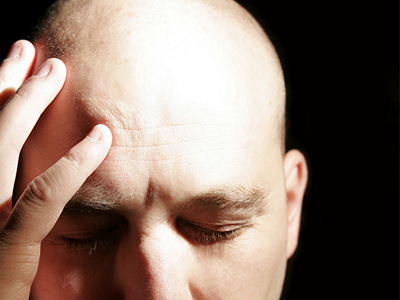  Androgenetik Saç Dökülmesi,  Androgenetik Alopesi
