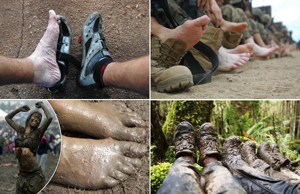 Siper Ayağı, Hendek Ayağı, Trench foot