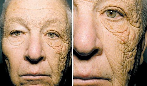Fotoyaşlanma, Güneşe Bağlı Yaşlanma, Fotoaging
