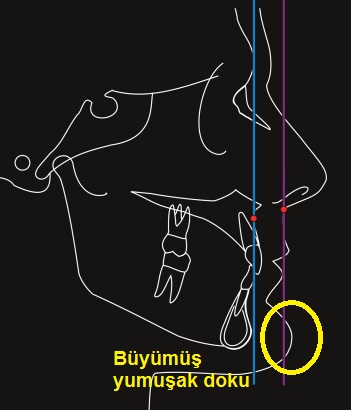 boyut 01