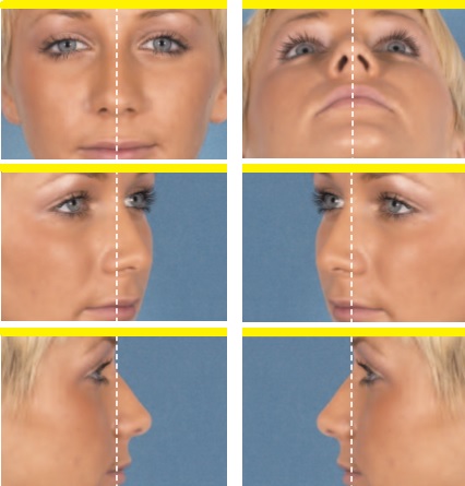 Yüz, Vücut Estetik Değerlendirmesinde Fotoğraflama ve Standartları